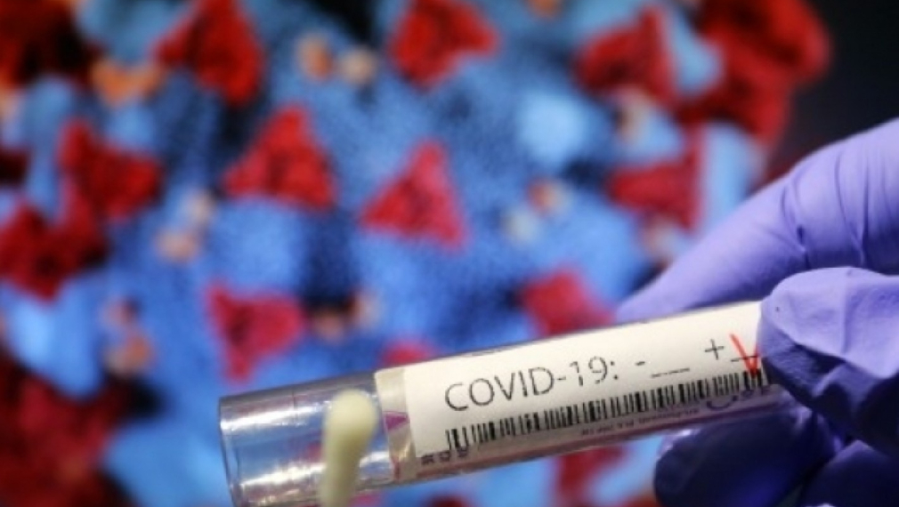 182 заразени с COVID-19 у нас за последното денонощие