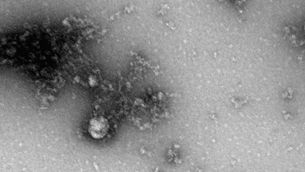 В Русия направиха първата снимка в света на "британския" щам на коронавирус