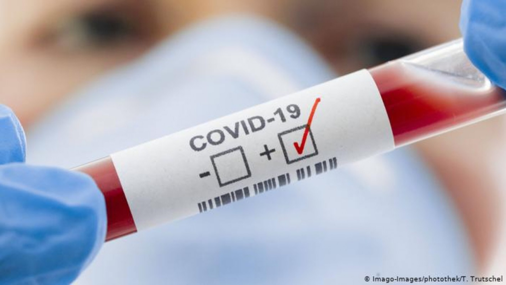 Само 348 са отчетените нови случаи на коронавирус у нас