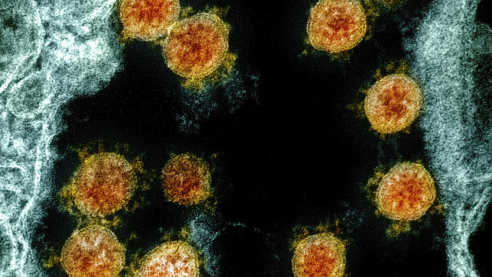 Проучване свърза 20% от смъртните случаи при COVID-19 с дефект в имунната система