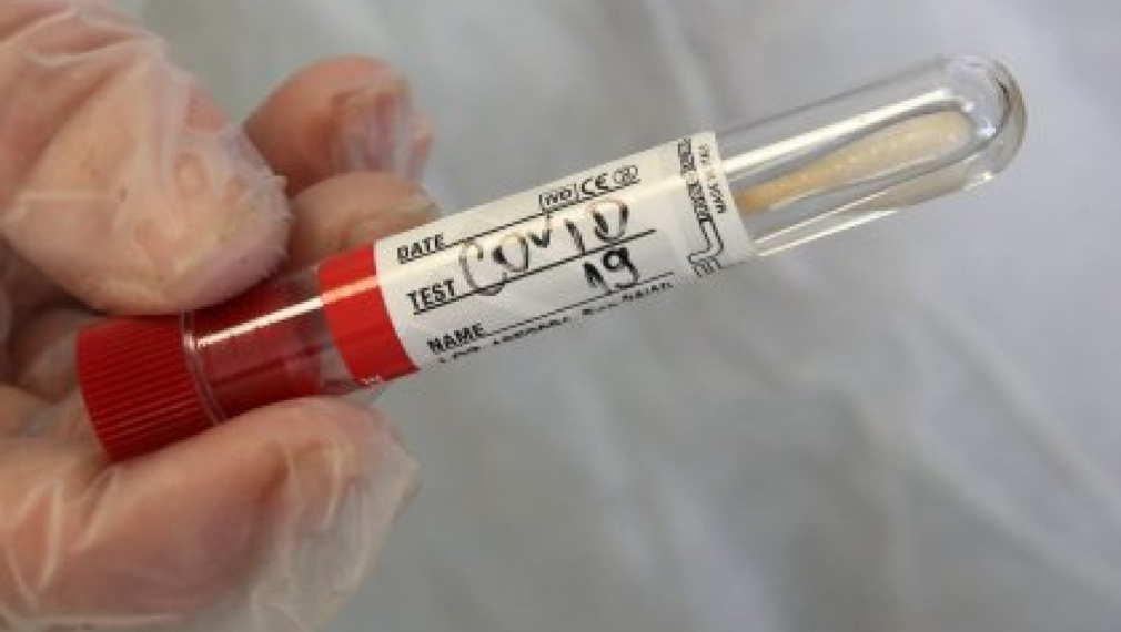99 починали с коронавирус за последните 24 часа