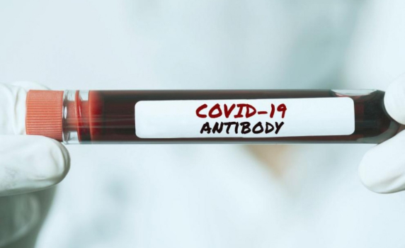 ЕК готова на сертификат за антитела срещу COVID-19