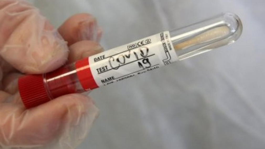 Рекордни 9996 нови случая на коронавирус у нас и над 160 починали