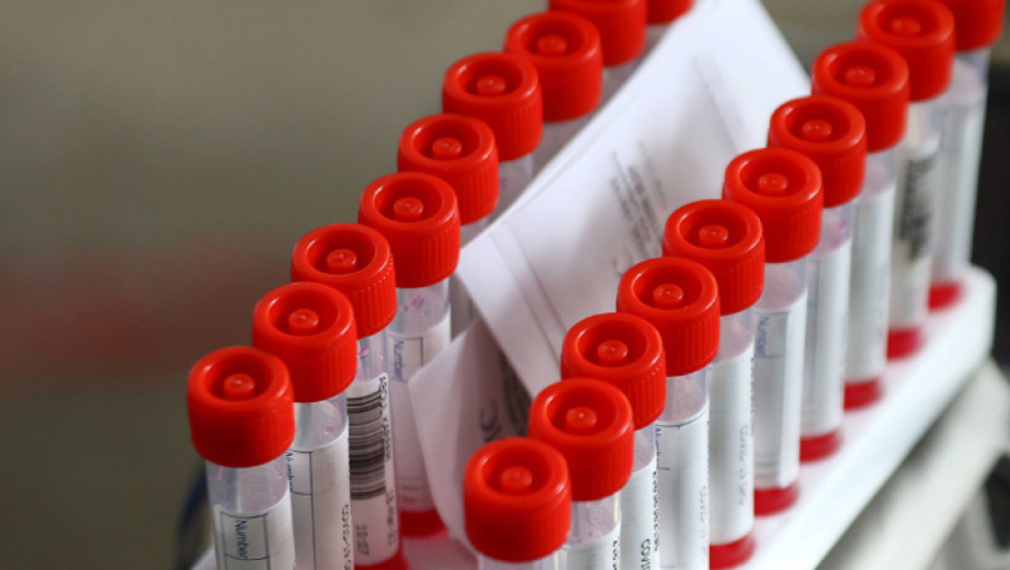 1539 са новите случаи на коронавирус у нас, положителни са 15,3% от пробите