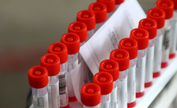 1539 са новите случаи на коронавирус у нас, положителни са 15,3% от пробите