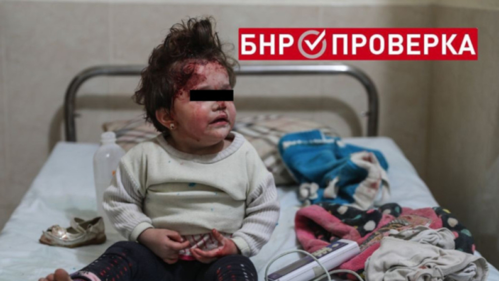 Детето от снимката не е пострадало във войната в Украйна, а в Сирия