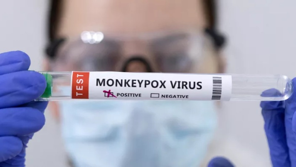 Ню Йорк обяви извънредна епидемиологична ситуация заради маймунската шарка