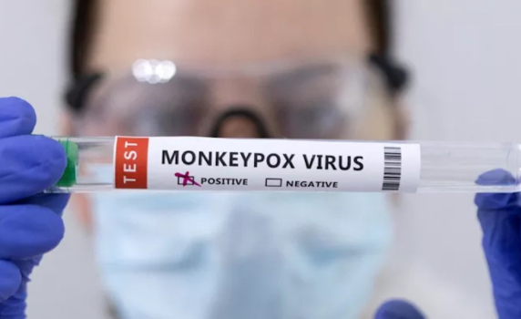 Ню Йорк обяви извънредна епидемиологична ситуация заради маймунската шарка