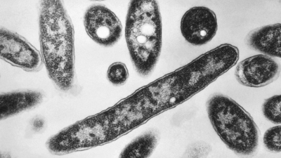 Снимка от електронен микроскоп от 1978 г показва бактерията Legionella